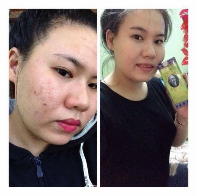 Luu Ban Nhap Tu Dong 3032
