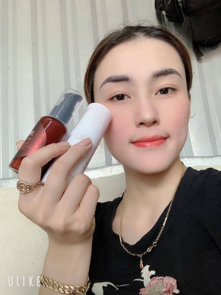 Dưỡng da an toàn và ngăn ngừa mụn, nám sau điều trị